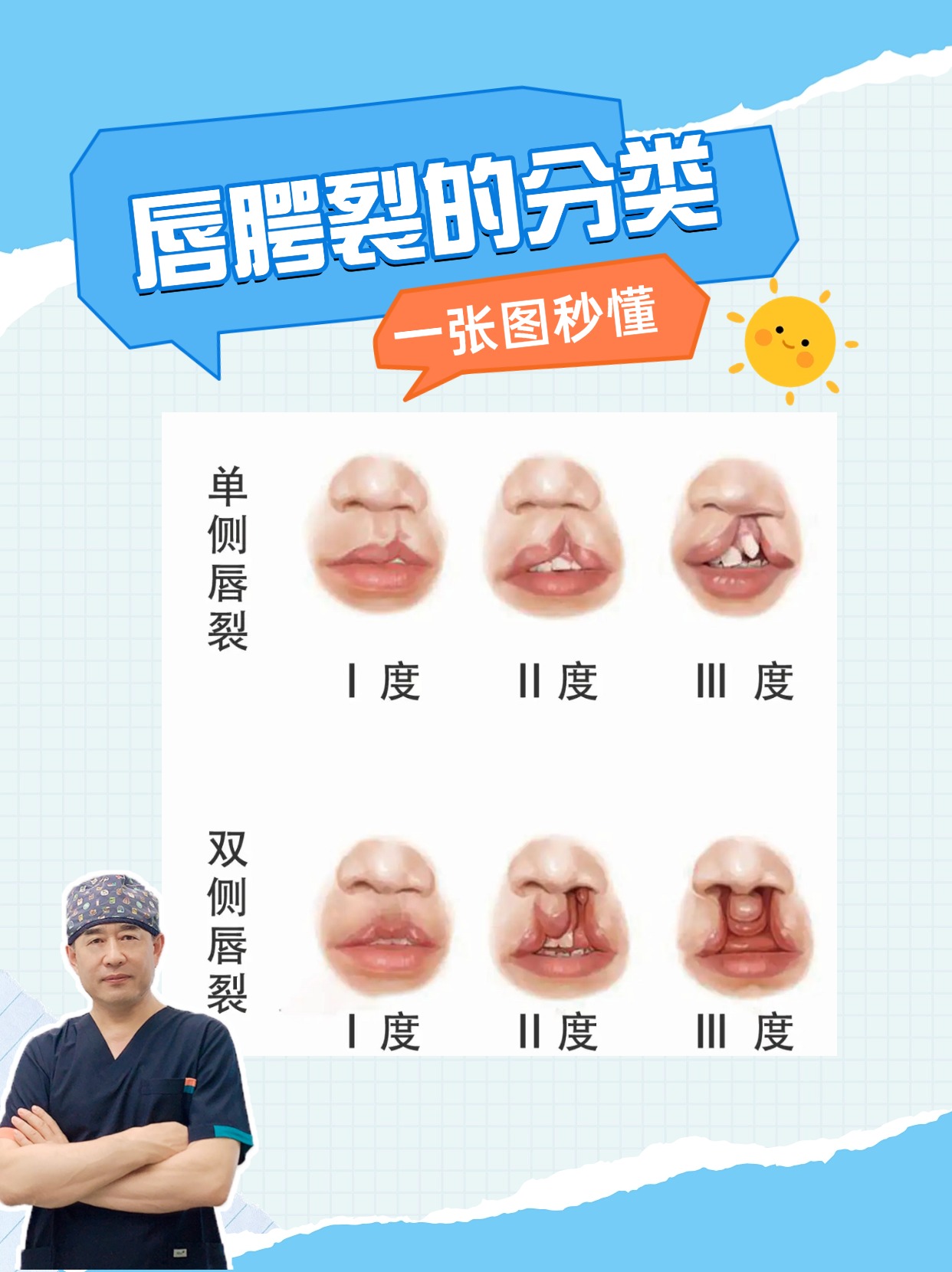 唇腭裂修复都需要经历哪些阶段?