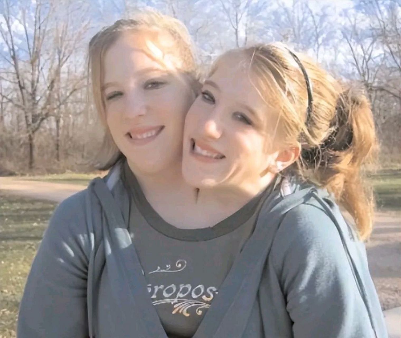 乌克兰一对"双头连体姐妹"嫁同一位丈夫,婚后生活十分幸福.