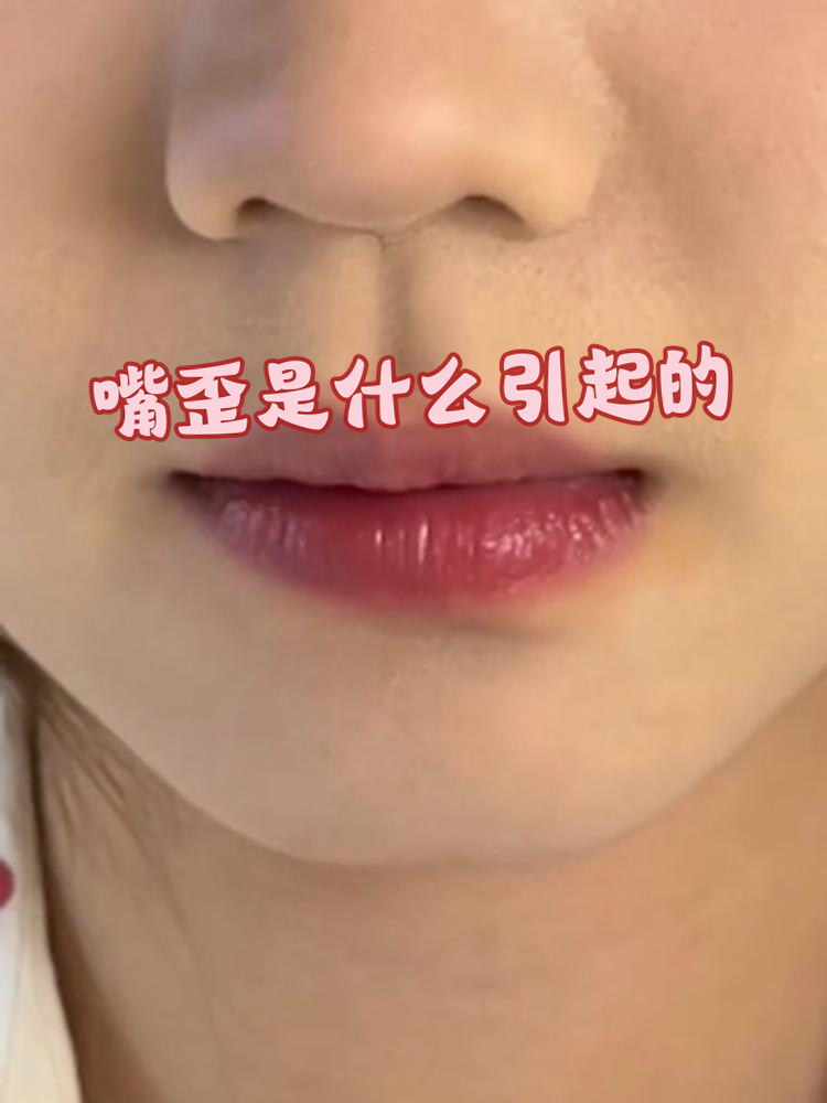 其实,嘴歪的原因有很多,可能是生活习惯,疾病,甚至是神经问题