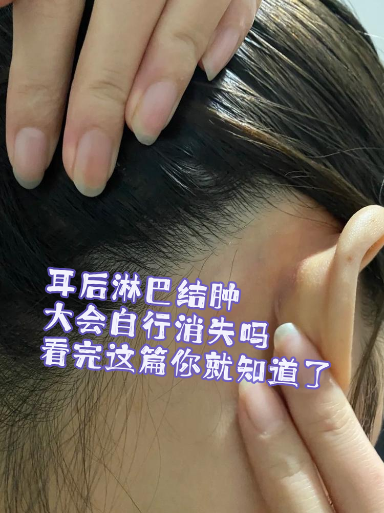 很多小伙伴可能会在不经意间发现自己耳后有小硬块,不禁担心:耳后