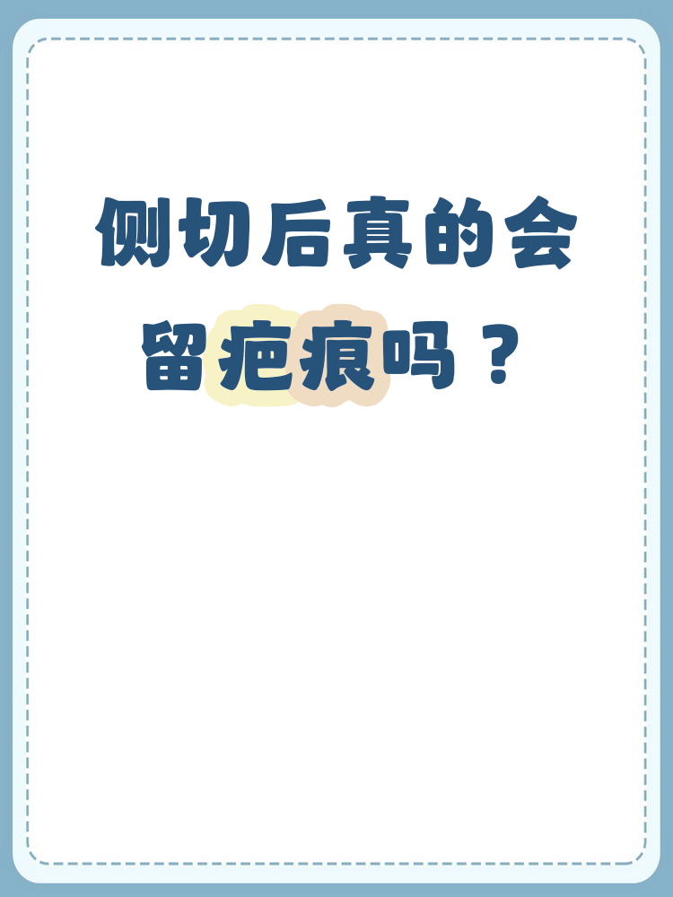 侧切会留疤吗 侧切会形成疤痕是由于皮肤切开后结缔组织增生引起的