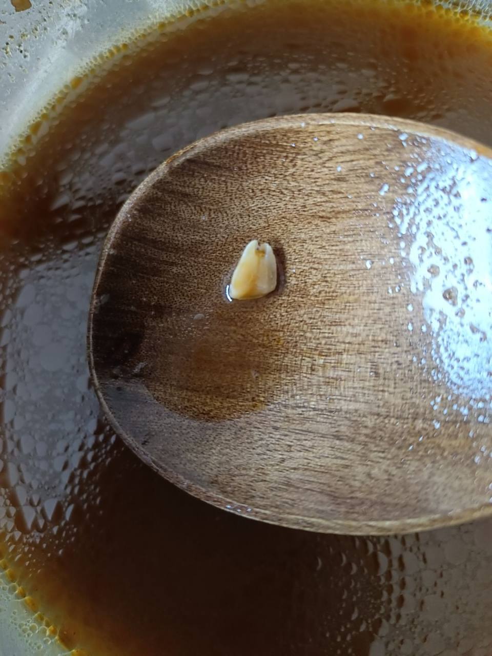 吃螺蛳粉把牙硌掉了