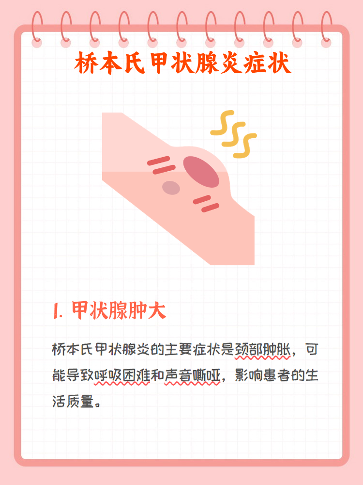 桥本氏病最明显的三种表现
