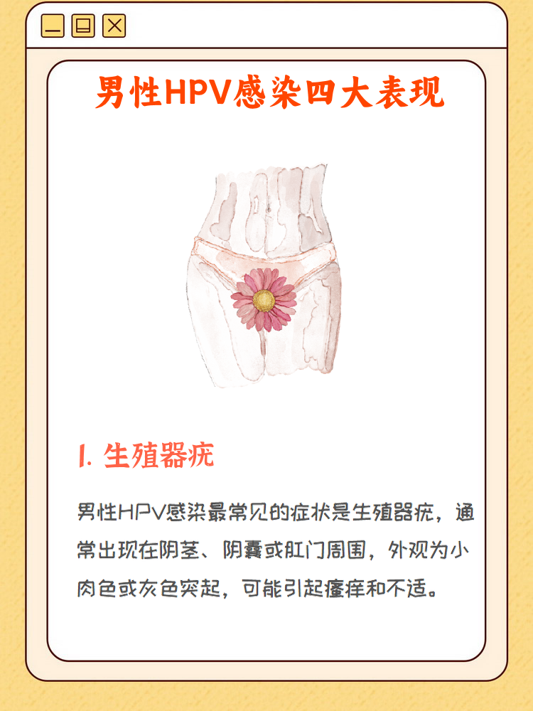 男性感染hpv的四大症状