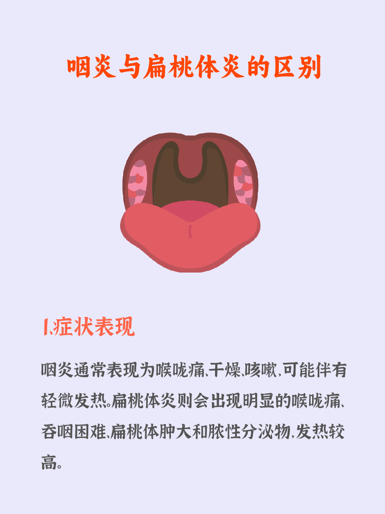 如何快速区分咽炎与扁桃体炎?看完你就懂了!