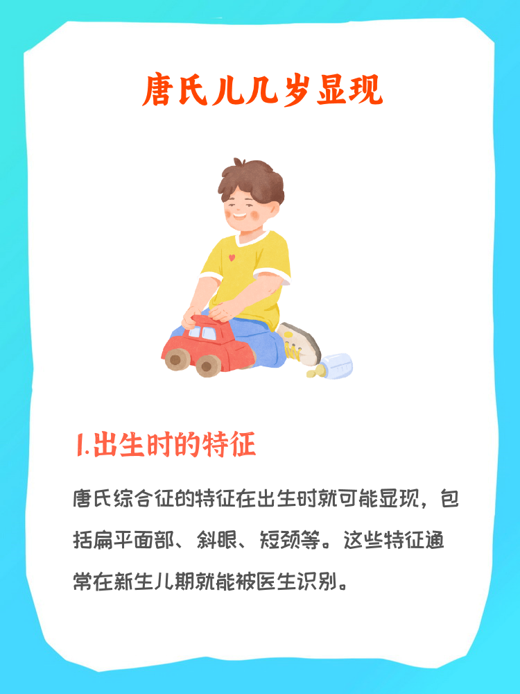 出生就能辨别唐氏婴儿特征图片唐氏儿0