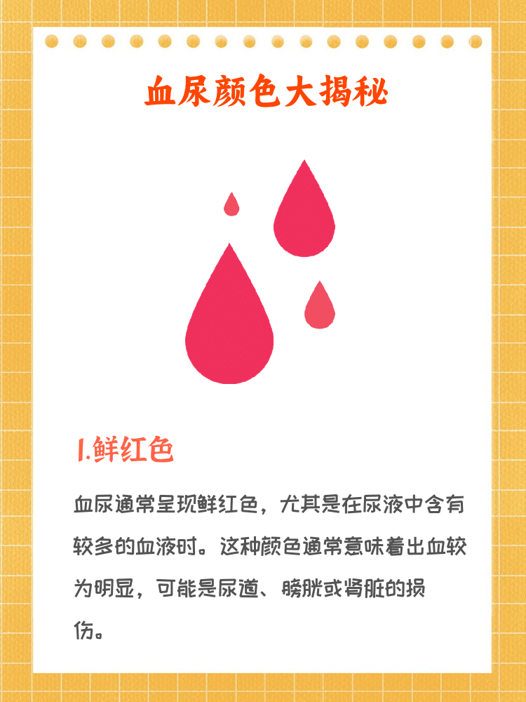 血尿颜色辨别尿液中带有轻微血血尿图片血尿是什么颜色及图片尿茶色尿