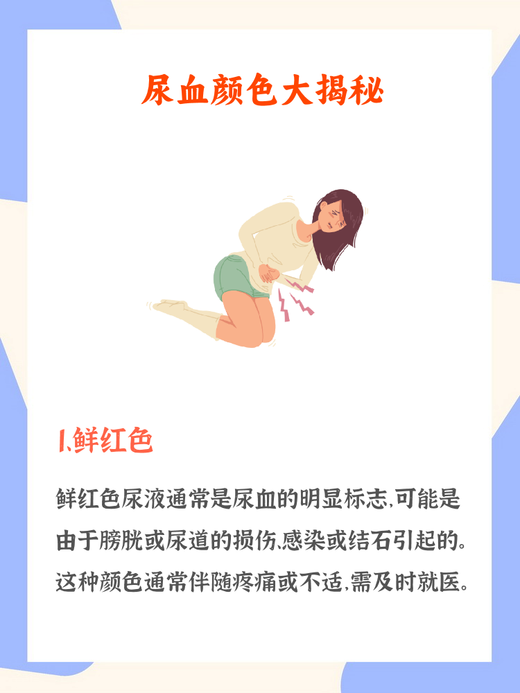 鲜红色尿液是尿血明显标志