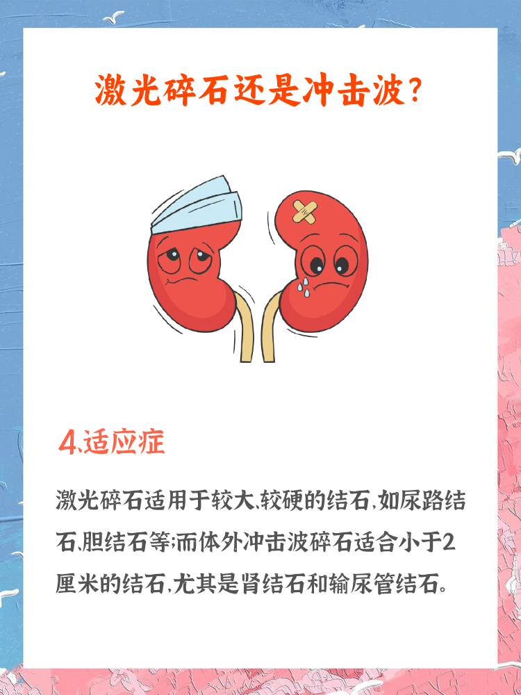 胆结石激光碎石图片