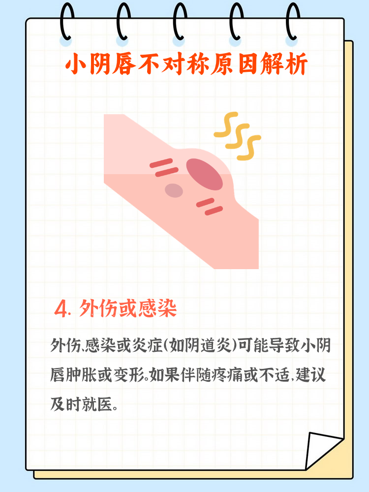 女人为什么会出现阴吹