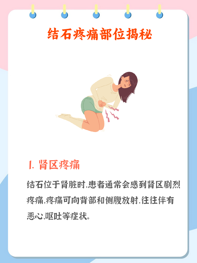 结石疼是在哪个部位疼