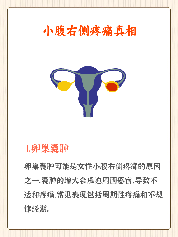 卵巢囊肿可能导致右侧疼痛