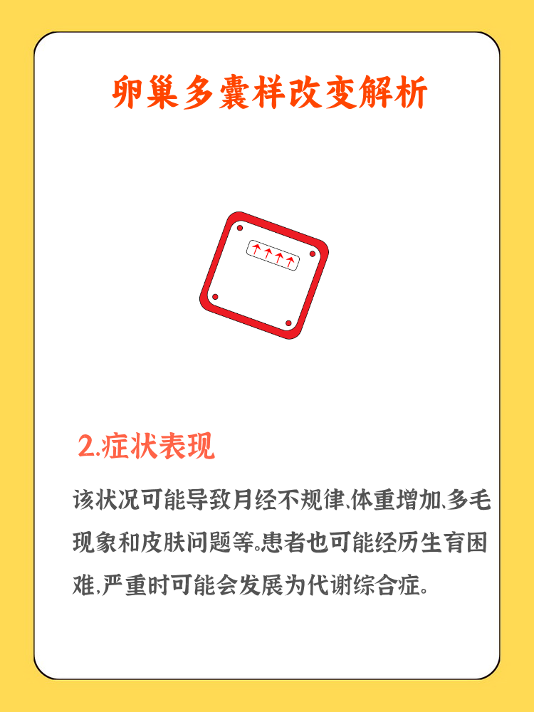 典型卵巢多囊怎么回事_典型多囊卵巢综合症严重吗