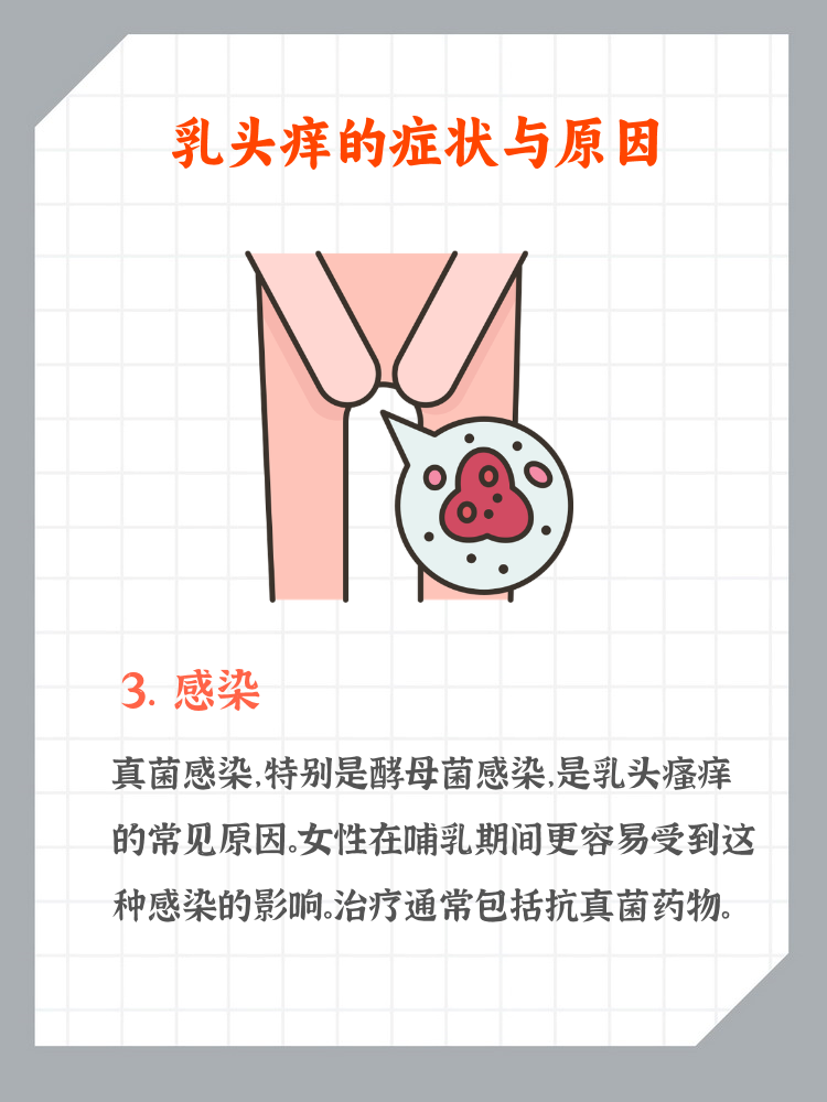 1. 乳头瘙痒可能是因过敏产生的