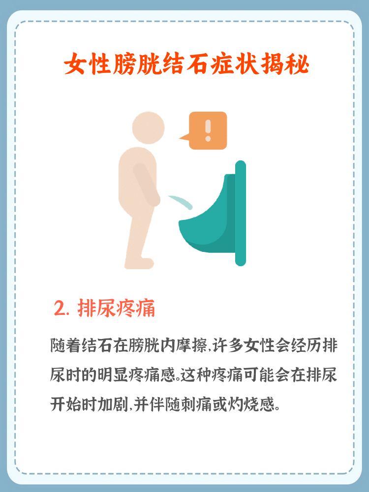 炎3个压痛点图片结石掉膀胱的6个征兆膀胱结石有哪些症状女性输尿管