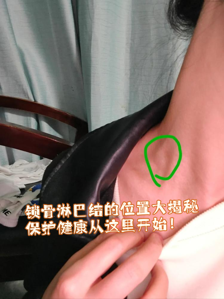 它不仅是美丽的象征,还与我们的健康息息相关,今天就来聊聊锁骨淋巴结