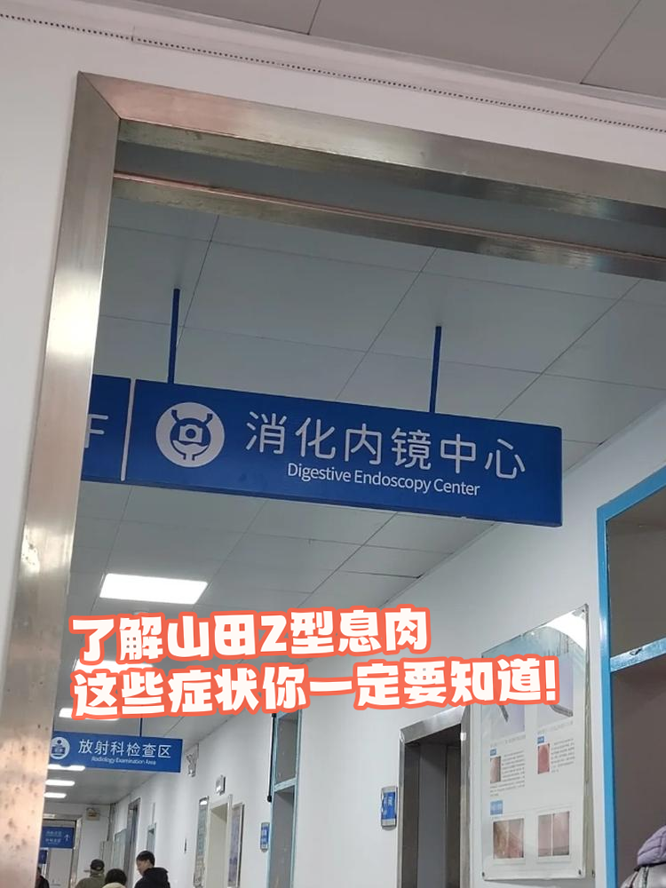 了解山田2型息肉:这些症状你一定要知道!