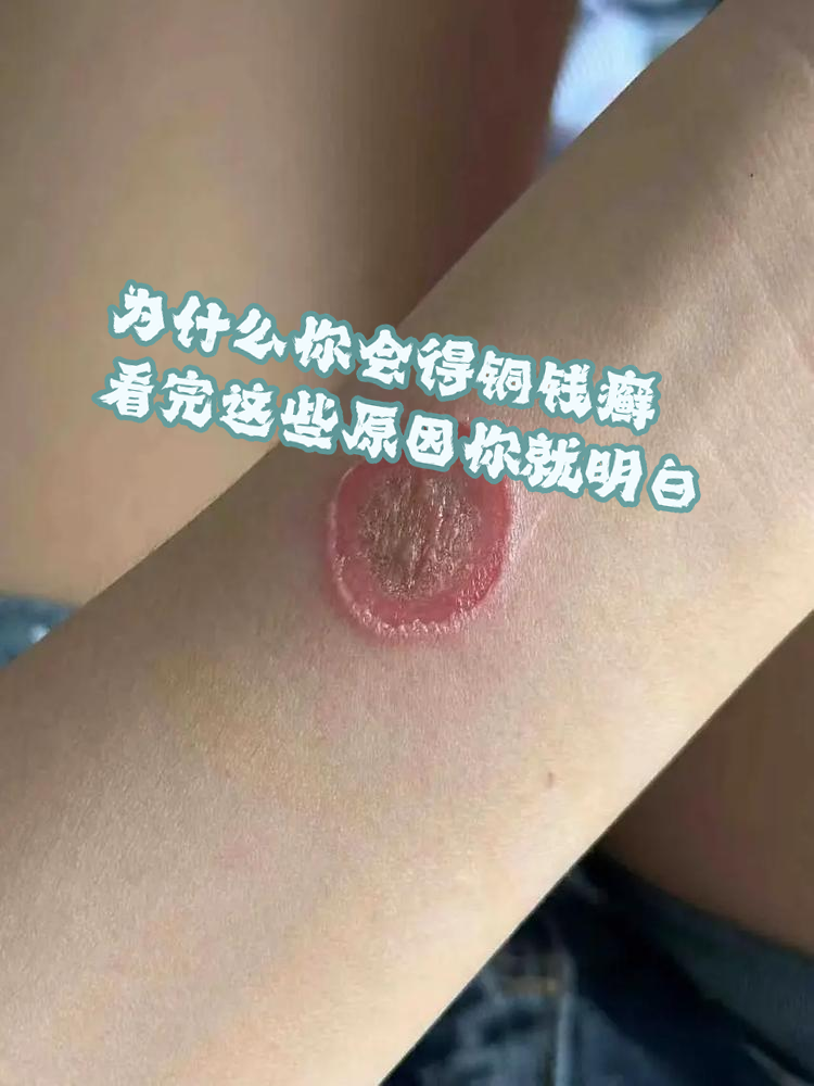 看完这些原因你就明白!