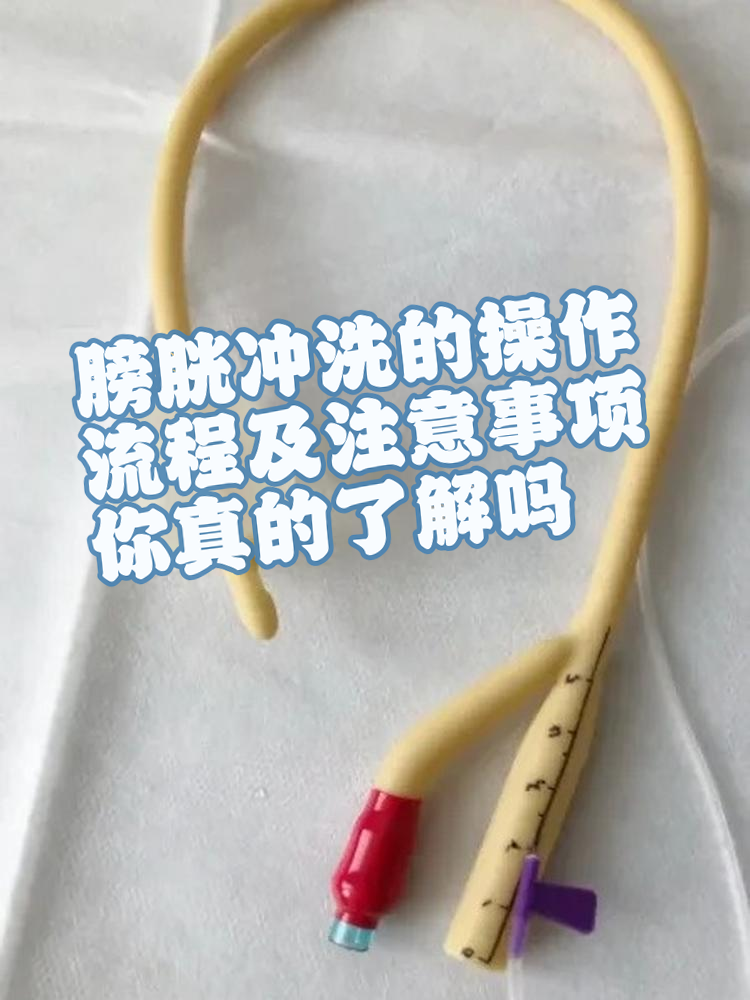 膀胱冲洗虽然听起来有点复杂,但掌握了正确的流程后,也会变得非常