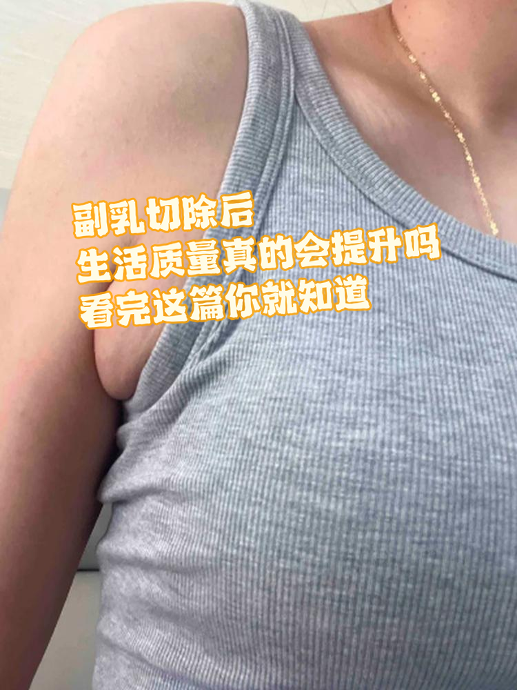 许多人可能不知道,副乳切除手术不仅仅是一个外科手术,它还可能是