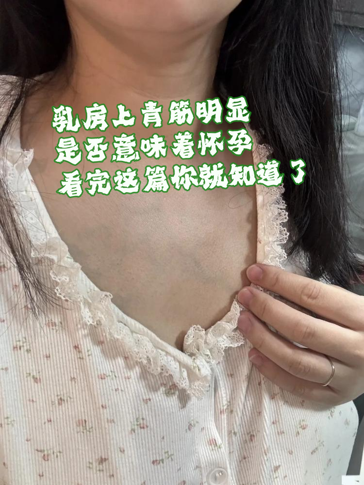 乳房上青筋明显,是否意味着怀孕?看完这篇你就知道了!