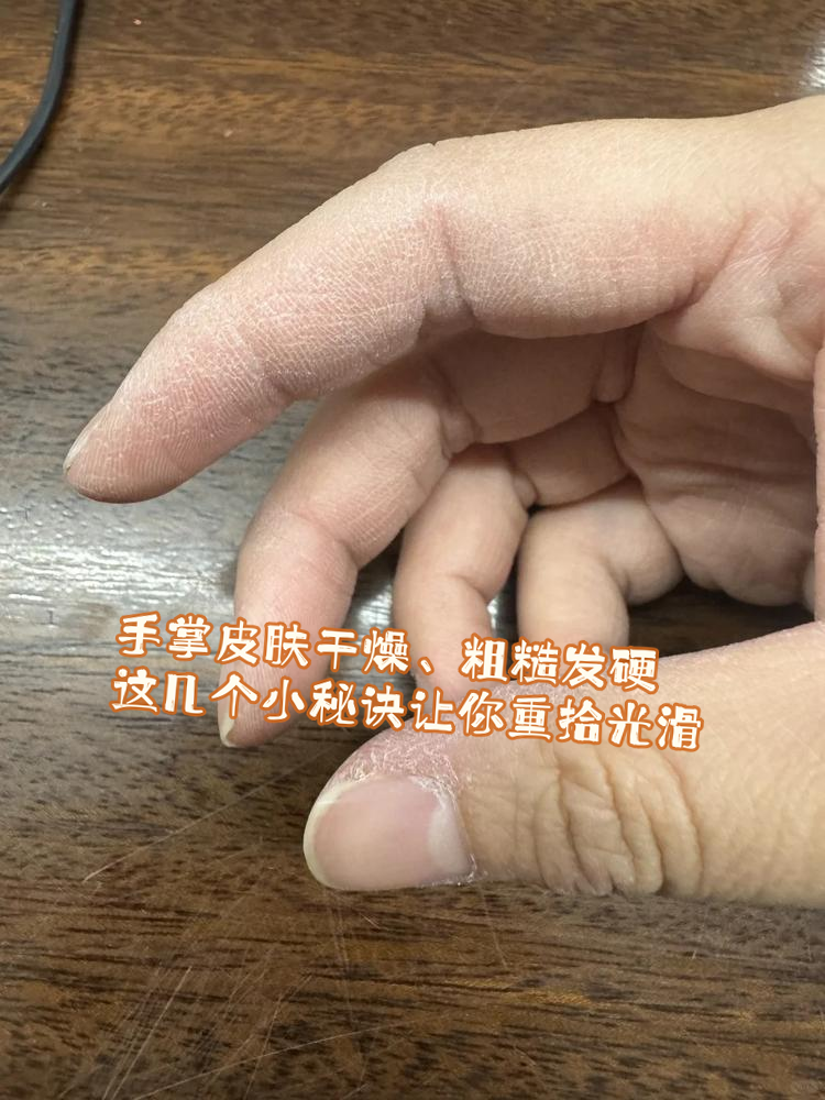 为什么手总是很凉