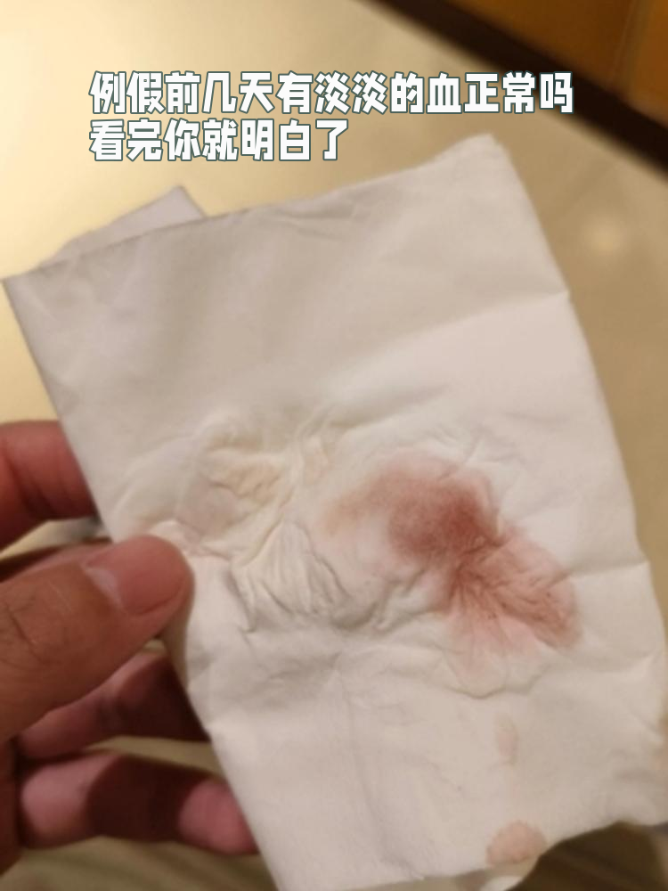 例假前几天有淡淡的血正常吗?看完你就明白了!