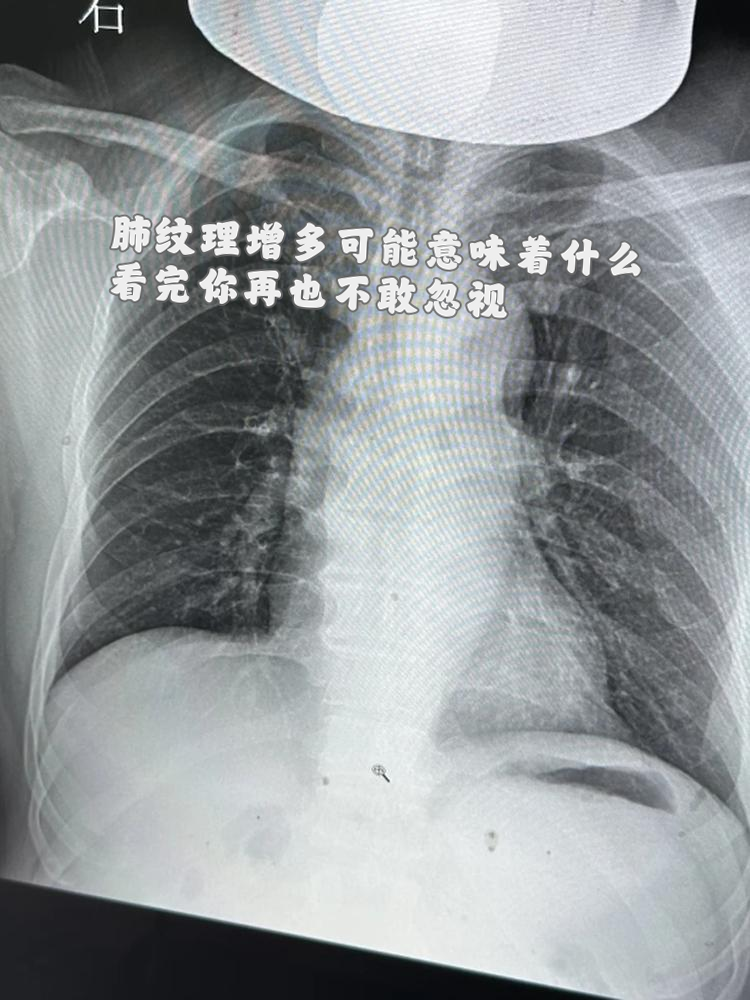 看完你再也不敢忽视!