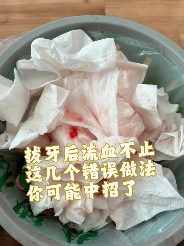 拔牙后流血是正常现象,但如果流血不止,可就要检查自己是不是做错了