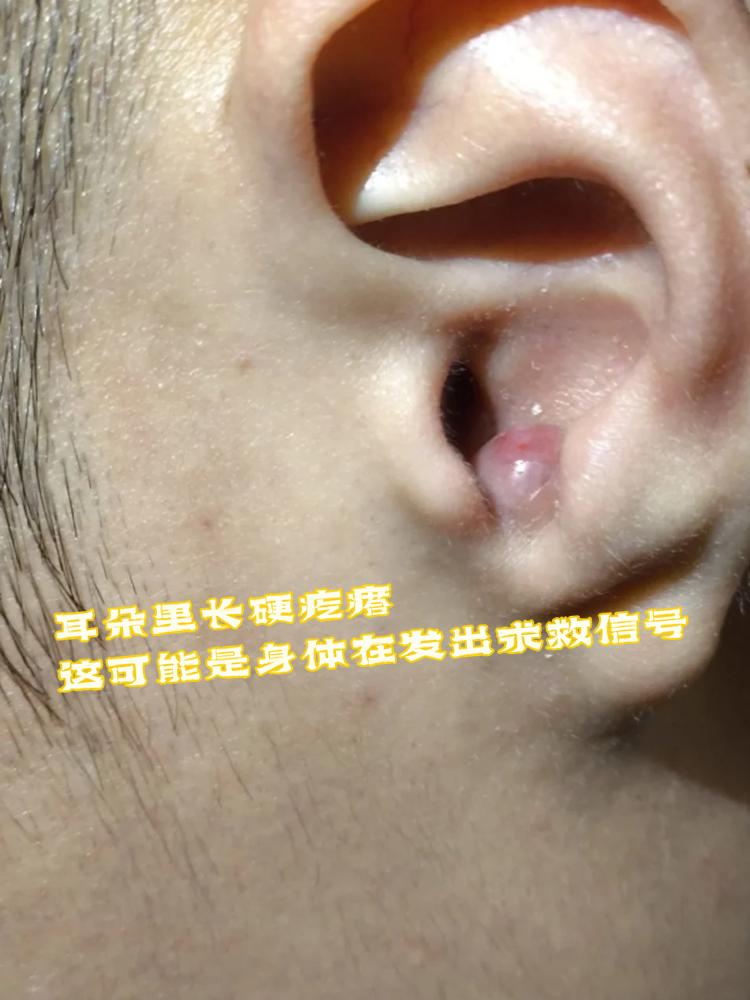 这可能是身体在发出求救信号!