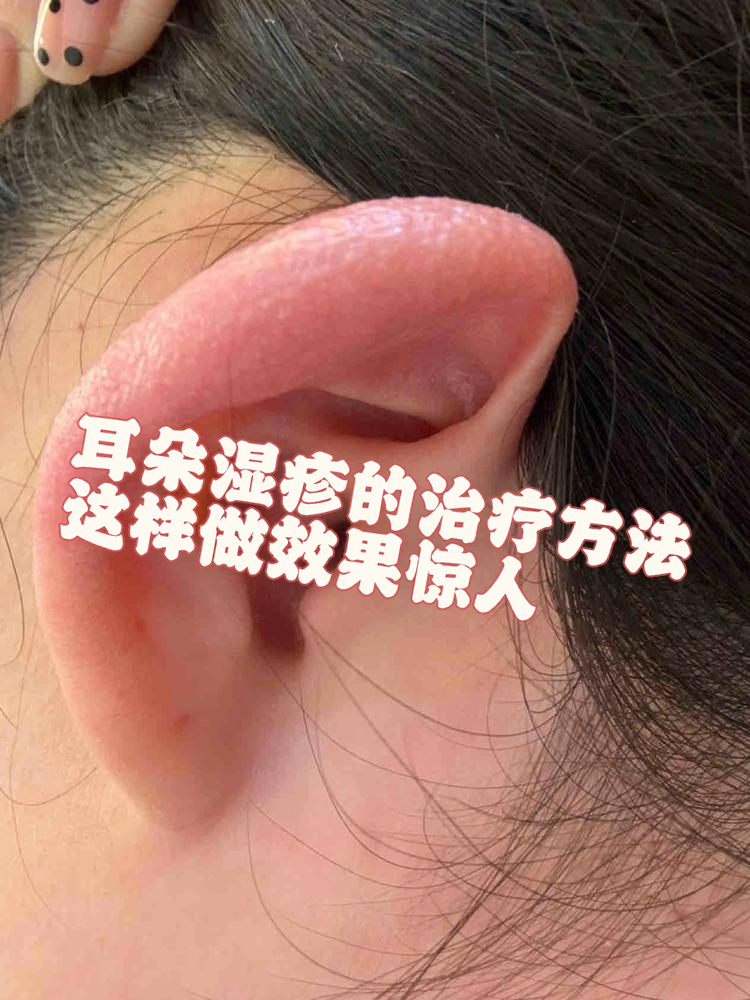 为什么会耳朵痒