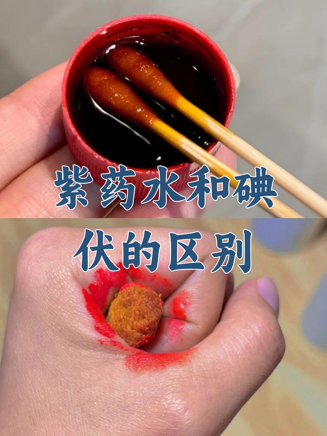 紫药水和碘伏的主要区别是:紫药水主要用于消毒