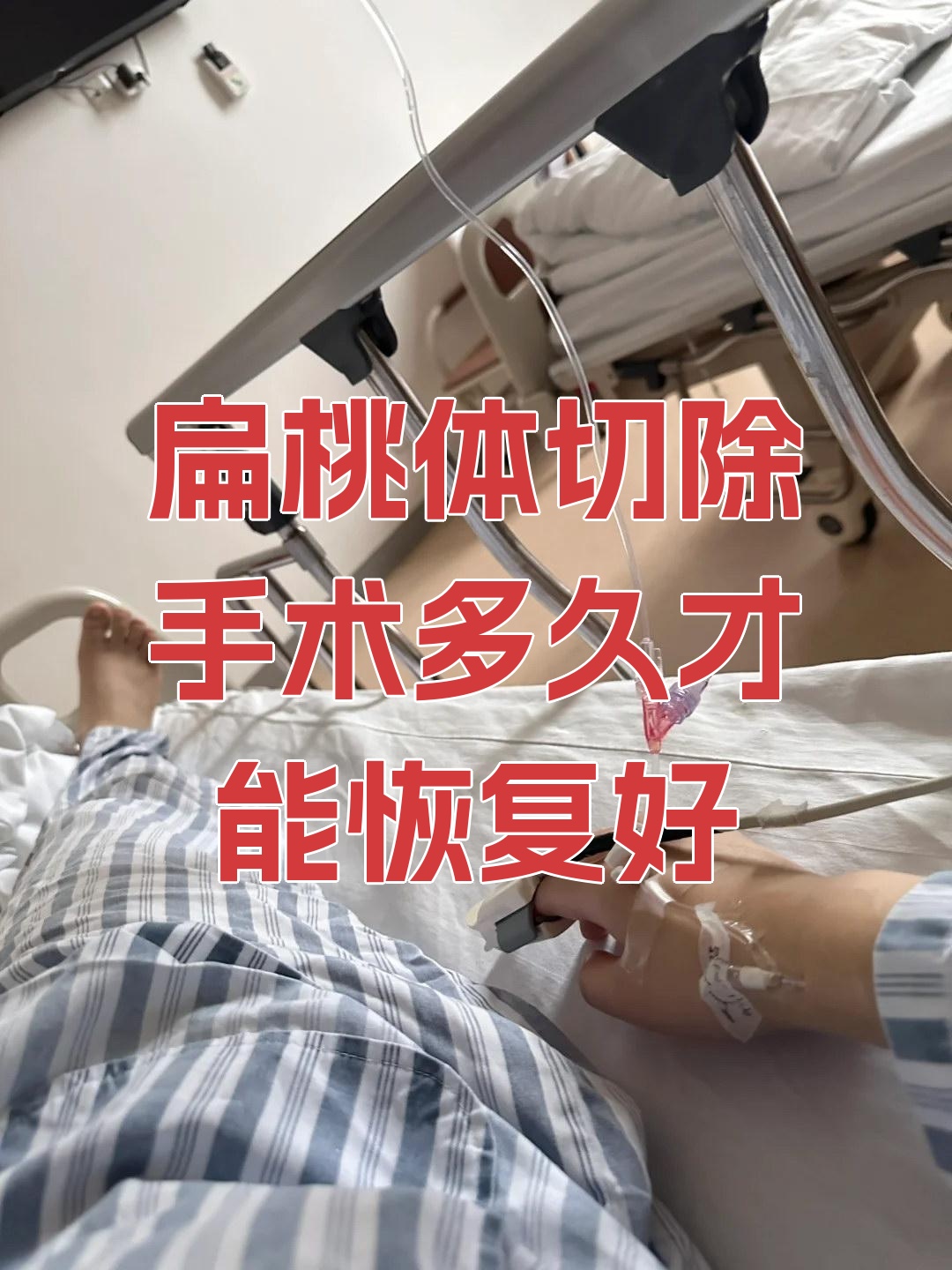 扁桃体切除手术多久才能恢复好