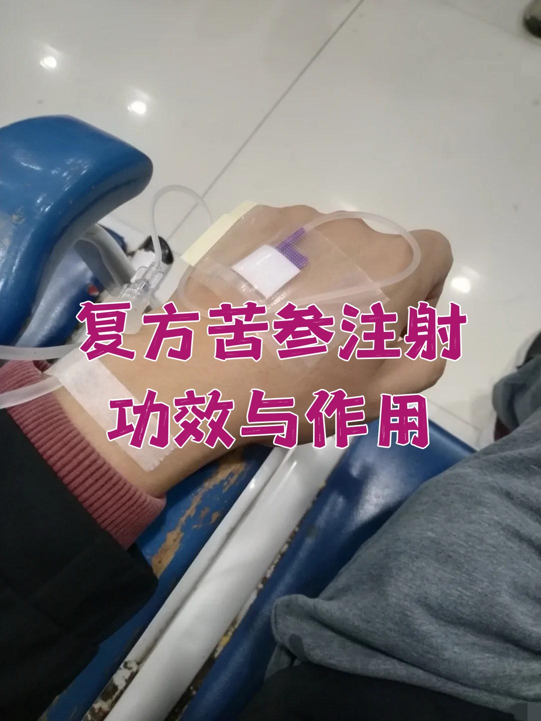  病毒性腹泻打针有用吗(病毒性腹泻能打预防针吗)
