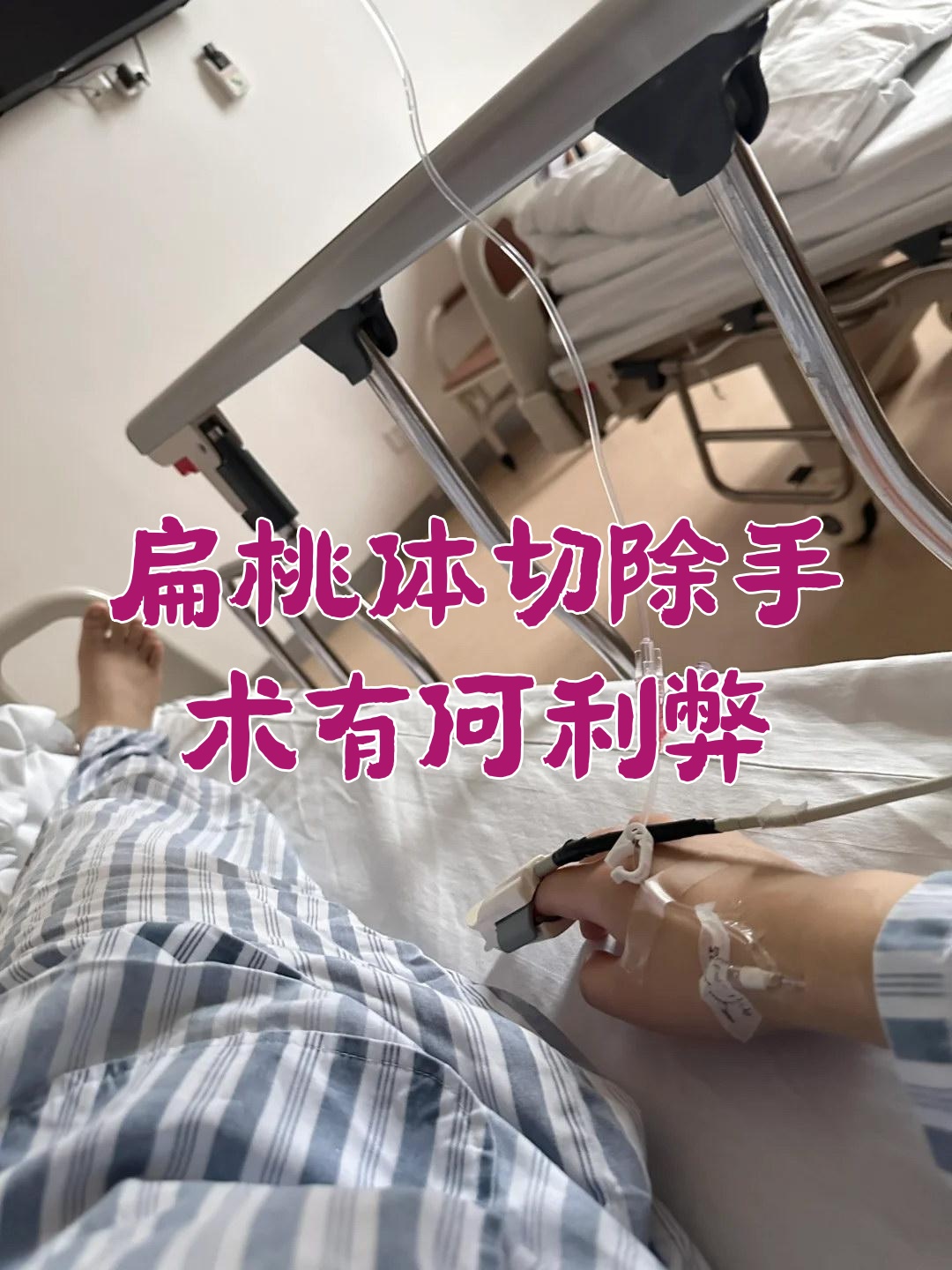 扁桃体切除手术有何利弊