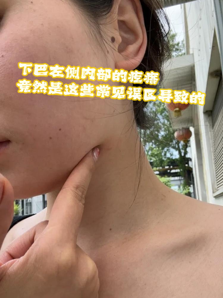 下巴左侧内部的疙瘩,竟然是这些常见误区导致的!