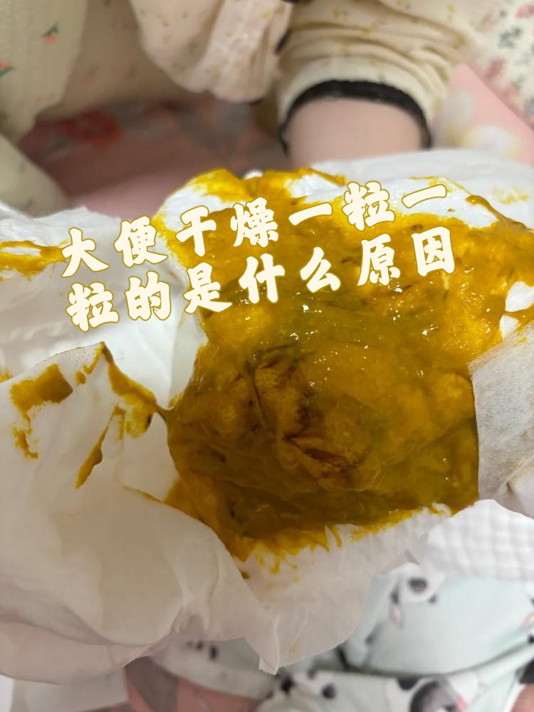 大便干燥一粒一粒的是什么原因