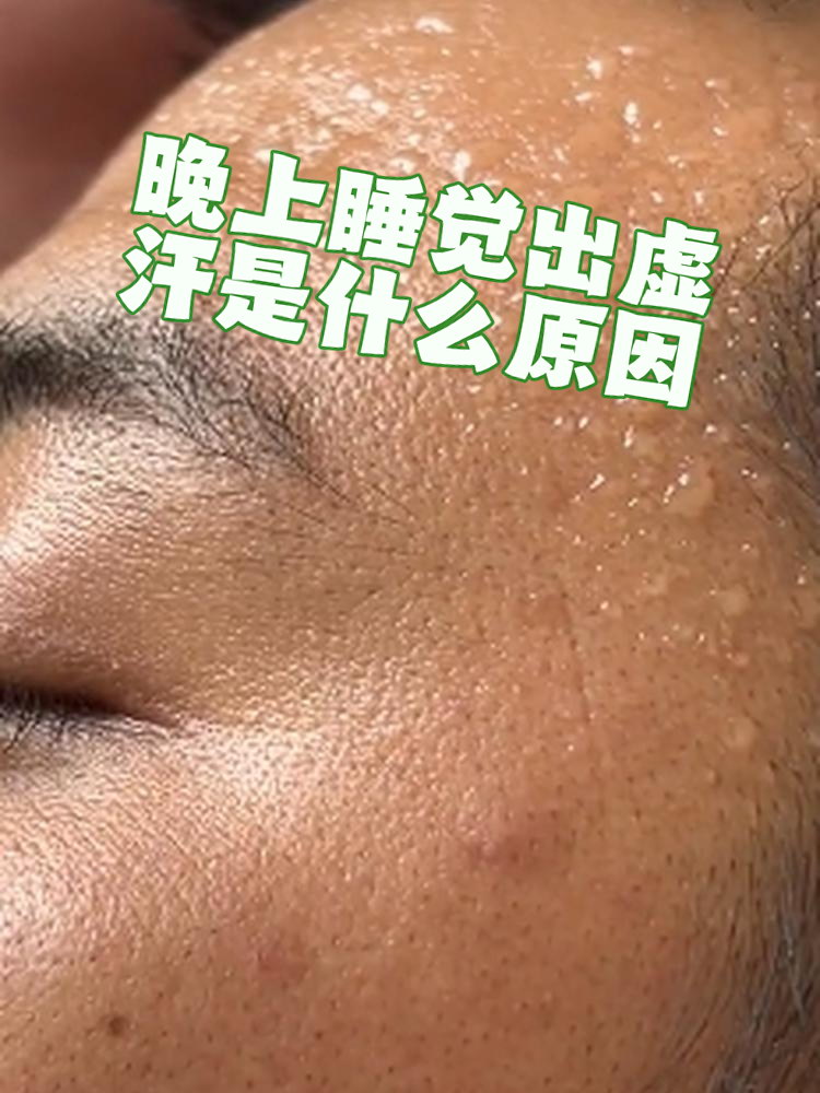 感冒为什么会出虚汗为什么在线 感冒为什么会出虚汗为什么在线