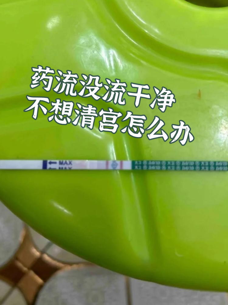 药流可以在家自己流吗(药流可以在家自己流吗两次身体以后会有问题吗)