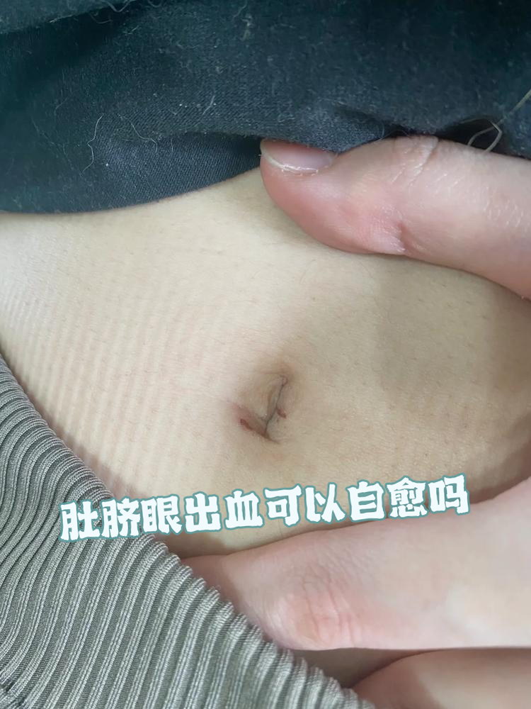 鲜胚移植第三天小腹隐隐作痛_移植鲜胚第三天肚子疼会成功吗