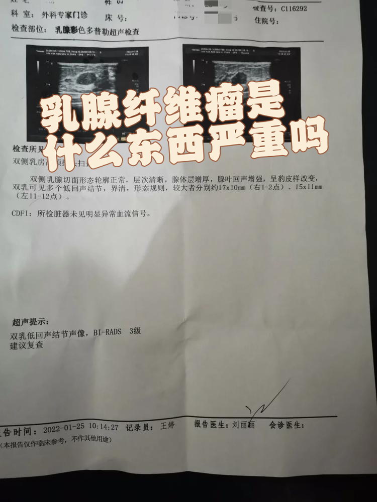 今天就来聊聊这个常见的乳腺问题,帮你消除疑虑,轻松应对