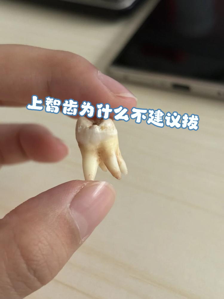 上智齿为什么不建议拔