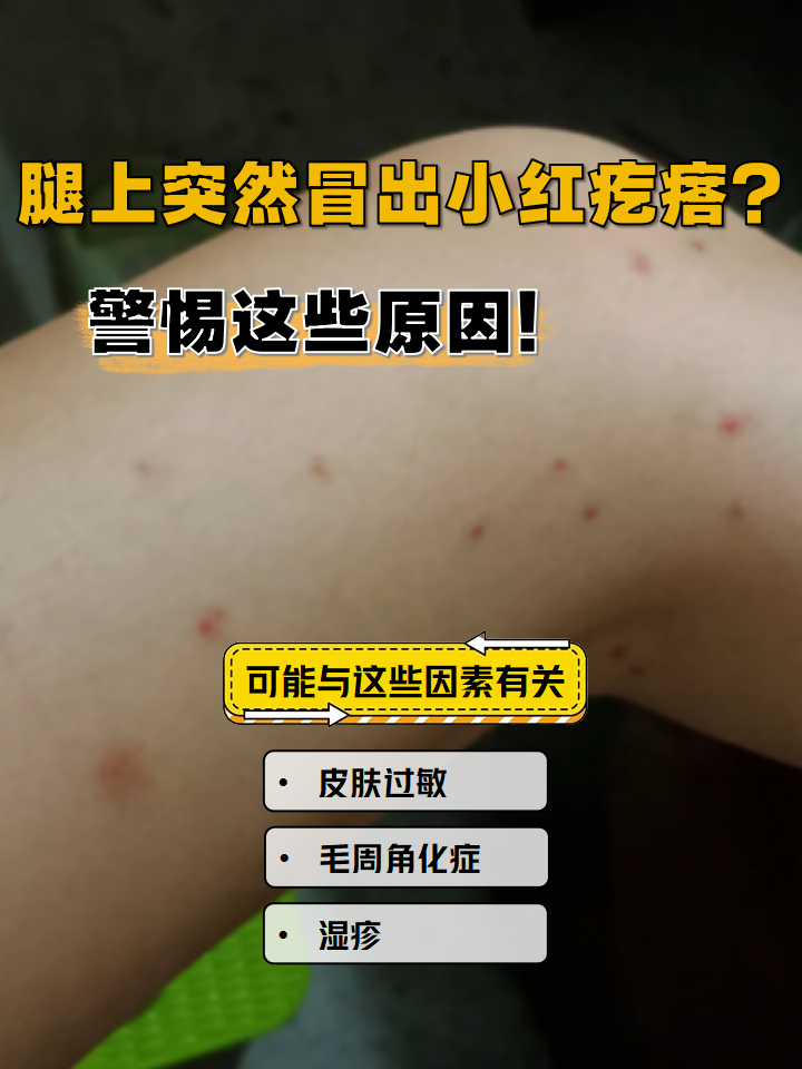 为什么腿上会痒