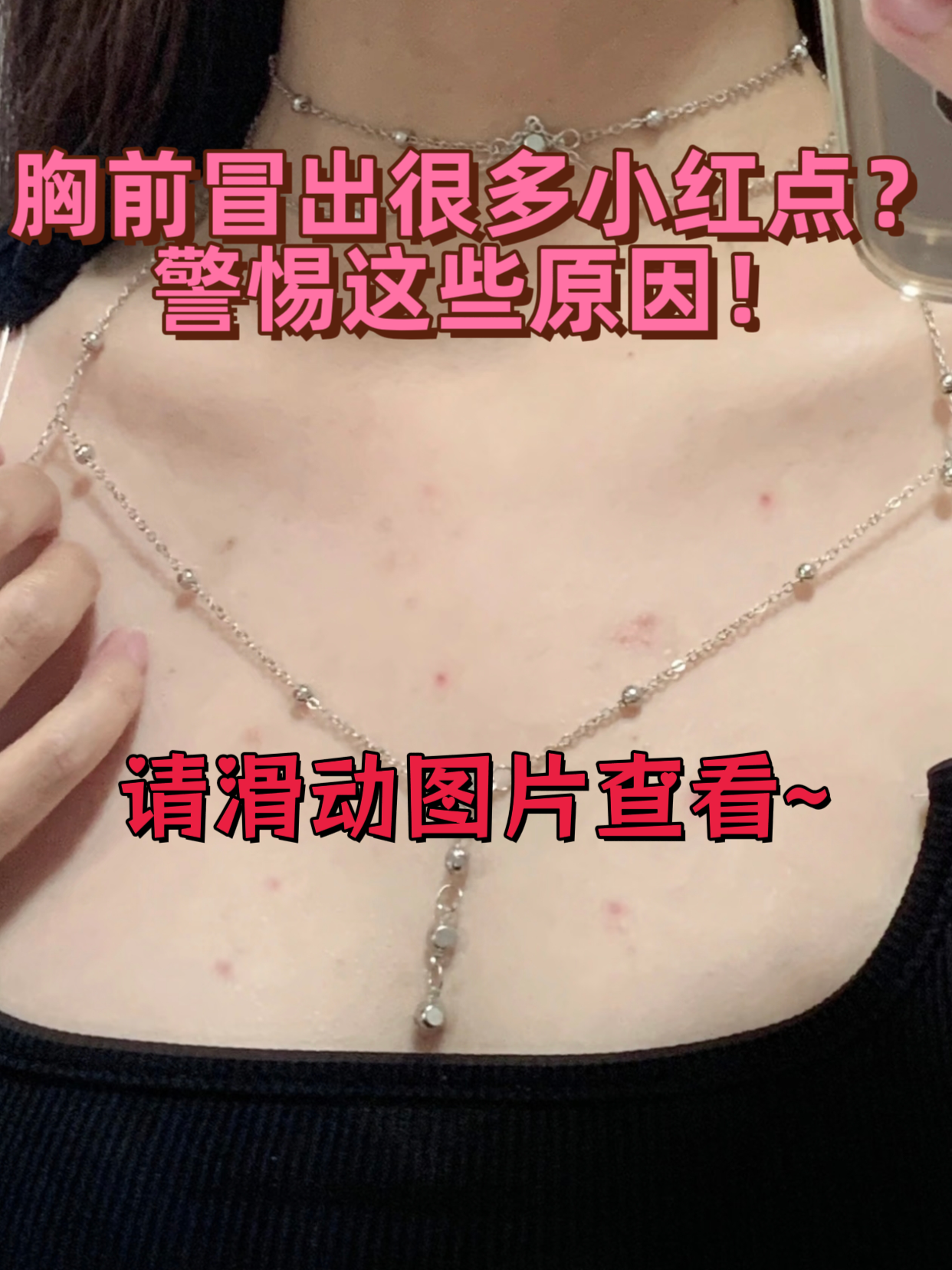 穿低领衣服时,胸前的小红点格外显眼