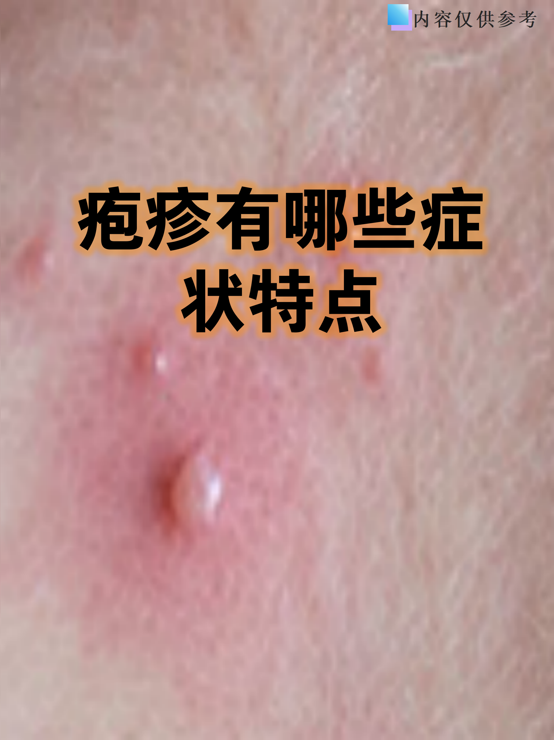 疱疹是一种常见的皮肤问题,很多人对它既熟悉又