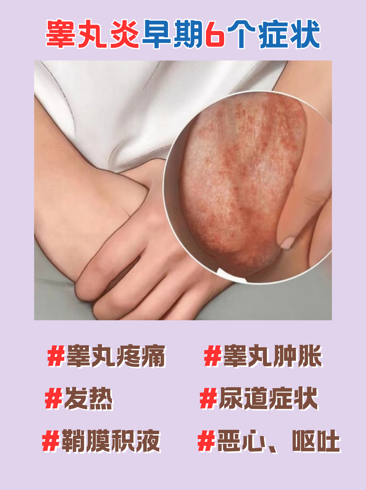 肿痛,发热别拖延!