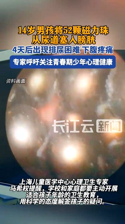 磁力珠子吃了的危害_磁力珠吃到肚子里多久有反应 磁力珠子吃了的危害_磁力珠吃到肚子里多久有反应