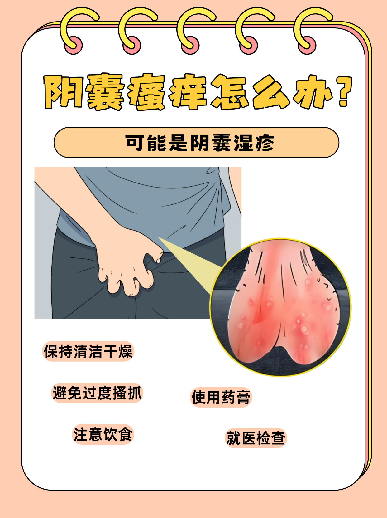 男性朋友们遇到这样的问题别担心,你可能是遇到了阴囊湿疹!