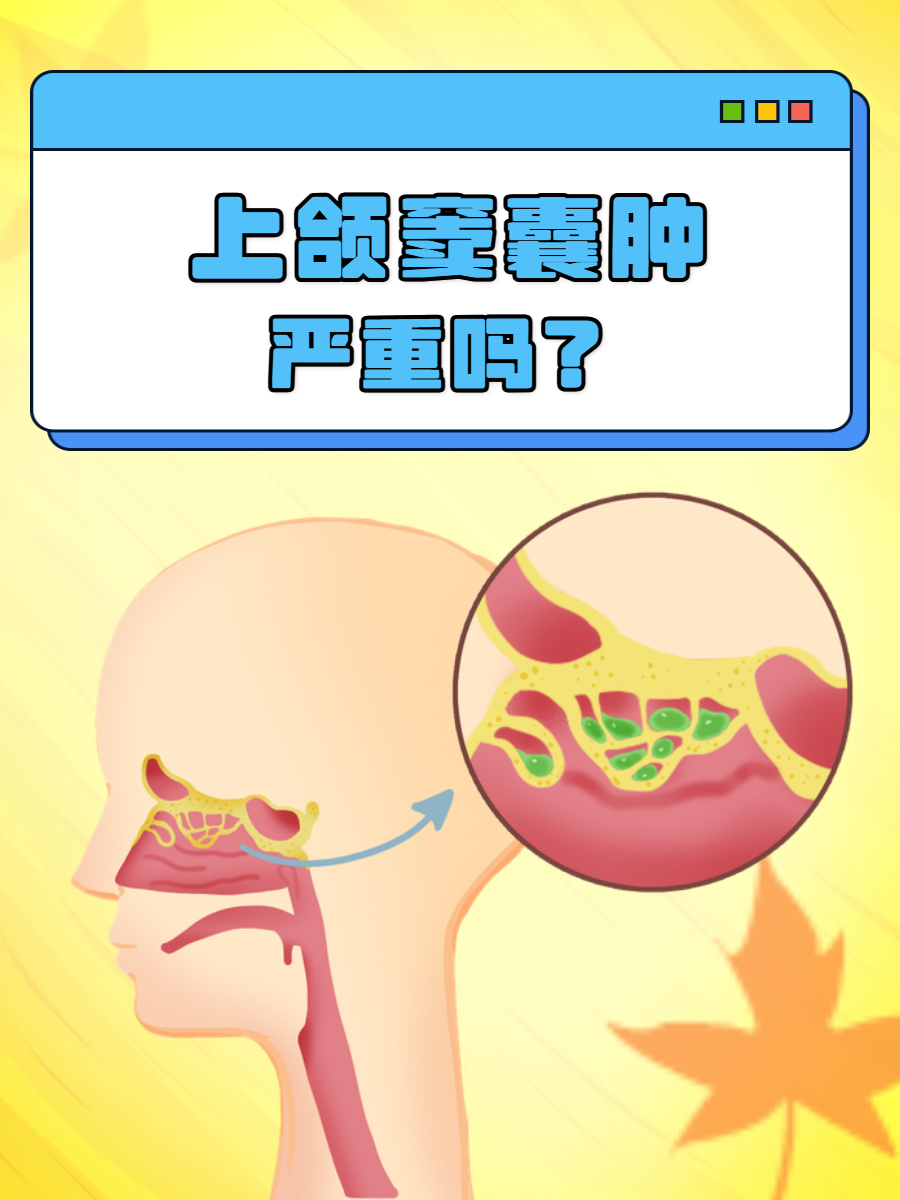 详解其严重性与应对策略