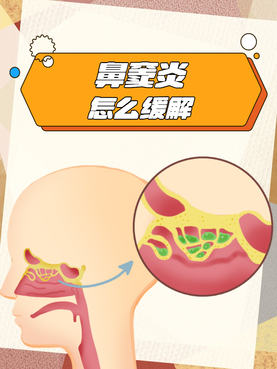 为什么会得鼻窦炎?为什么在线